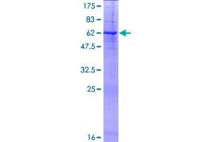PRSS21 Protein (AA 1-314) (GST tag)