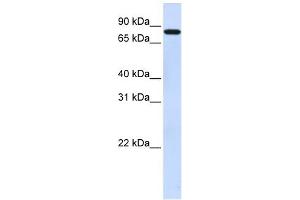 WB Suggested Anti-ZNF287 Antibody Titration:  0. (ZNF287 antibody  (N-Term))