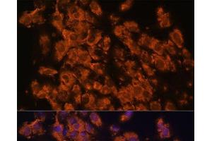 Immunofluorescence analysis of C6 cells using LRRC7 Polyclonal Antibody at dilution of 1:100. (LRRC7 antibody)