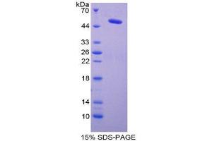 SDS-PAGE (SDS) image for Lysyl Oxidase (LOX) (AA 213-417) protein (His tag,GST tag) (ABIN2123207)