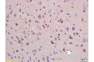 Formalin-fixed and paraffin embedded rat brain labeled with Rabbit Anti SYTL5/slp5 Polyclonal Antibody, Unconjugated (ABIN754498) at 1:200 followed by conjugation to the secondary antibody and DAB staining (SYTL5 antibody  (AA 801-921))