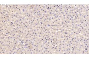 Detection of APOE in Rat Liver Tissue using Polyclonal Antibody to Apolipoprotein E (APOE) (APOE antibody  (AA 19-168))