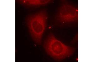 Immunofluorescence staining of methanol-fixed Hela cells using Phospho-LIMK2-T505 antibody. (LIMK2 antibody  (pThr505))