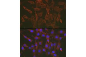 Immunofluorescence analysis of NIH/3T3 cells using ERK1 / ERK2 Rabbit pAb (ABIN7268619) at dilution of 1:50 (40x lens). (ERK1 antibody  (AA 200-300))