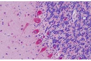 Human, Brain, Cerebellum: Formalin-Fixed Paraffin-Embedded (FFPE)