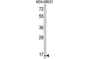 Western blot analysis of TSHB Antibody (Center) in MDA-MB231 cell line lysates (35ug/lane).