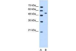 WB Suggested Anti-PLIN Antibody Titration:  1. (PLIN1 antibody  (N-Term))