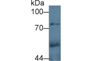 Detection of CPE in Rat Cerebrum lysate using Polyclonal Antibody to Carboxypeptidase E (CPE) (CPE antibody  (AA 318-476))