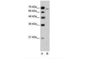 图1为抗阿法丁（MLLT4）（AA 152-201）抗体（ABIN204949）（阿法丁抗体（AA 152-2001））