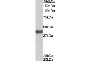 ABIN570946 (1 µg/mL) staining of Human Skeletal Muscle lysate (35 µg protein in RIPA buffer). (FBXO32 antibody  (Internal Region))