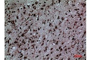 Immunohistochemistry (IHC) image for anti-Protein Disulfide Isomerase Family A, Member 3 (PDIA3) (Internal Region) antibody (ABIN6280937)