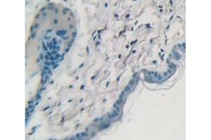 IHC-P analysis of Mouse Tissue, with DAB staining. (Cytokeratin 1 antibody  (AA 189-497))