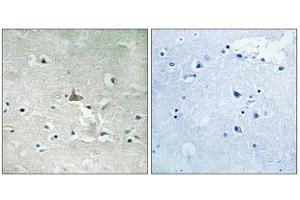 Immunohistochemistry analysis of paraffin-embedded human brain tissue using Trk B (Phospho-Tyr706+Tyr707) antibody. (TRKB antibody  (pTyr706, pTyr707))