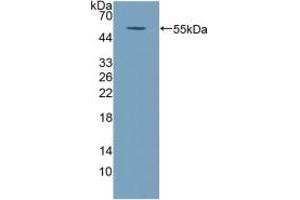 Detection of Recombinant COQ6, Human using Polyclonal Antibody to Coenzyme Q6 Homolog, Monooxygenase (COQ6) (COQ6 antibody  (AA 1-468))