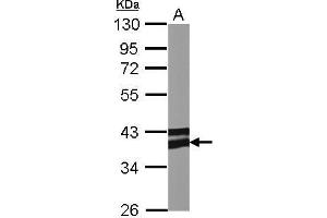 WB Image Sample (50 ug of whole cell lysate) (Adiponectin Receptor 1 antibody  (C-Term))
