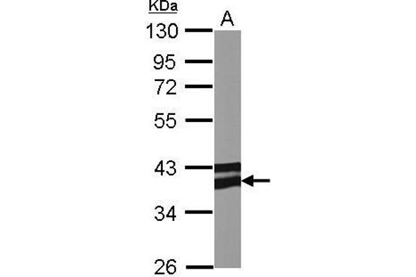 Adiponectin Receptor 1 antibody  (C-Term)