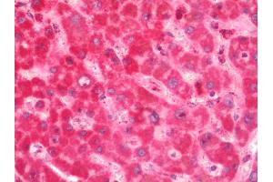 Human Liver: Formalin-Fixed, Paraffin-Embedded (FFPE). (CS antibody  (FITC))