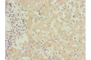 Immunohistochemistry of paraffin-embedded human liver tissue using ABIN7149960 at dilution of 1:100