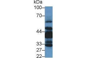 Western Blot; Sample: Human Lung lysate; Primary Ab: 1µg/ml Rabbit Anti-Human LIMS1 Antibody Second Ab: 0. (LIMS1 antibody  (AA 68-303))