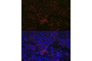 Immunofluorescence analysis of mouse spleen using CXCR3 Rabbit mAb (ABIN7266318) at dilution of 1:100 (40x lens). (CXCR3 antibody)