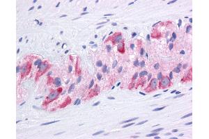 Immunohistochemistry (IHC) image for anti-Heat Shock Protein 90kDa alpha (Cytosolic), Class A Member 1 (HSP90AA1) (N-Term) antibody (ABIN2779296) (HSP90AA1 antibody  (N-Term))