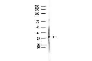 anti-Zinc Finger Protein 691 (ZNF691) (Internal Region) antibody