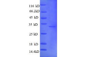 SDS-PAGE (SDS) image for Metallothionein 1A (MT1A) (AA 1-59), (partial) protein (GST tag) (ABIN5713090)