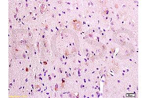 Formalin-fixed and paraffin embedded rat brain tissue labeled Anti-P38 MAPK (Phospho-Thr180/Tyr182) Polyclonal Antibody, Unconjugated (ABIN671226) at 1:200, followed by conjugation to the secondary antibody and DAB staining (MAPK14 antibody  (pThr180, pTyr182))