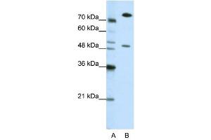 SSB antibody used at 0. (SSB antibody)