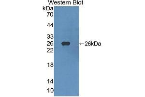Western blot analysis of the recombinant protein. (FGFR4 antibody  (AA 165-366))