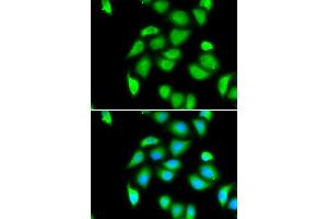 Immunofluorescence analysis of MCF7 cells using RPS5 antibody.