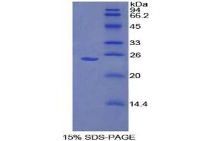 SDS-PAGE analysis of Mouse Sprouty Homolog 1 Protein. (SPRY1 Protein)