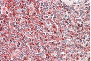 ABIN1590084 (5µg/ml) staining of paraffin embedded Human Spleen. (PKC beta antibody  (Internal Region))