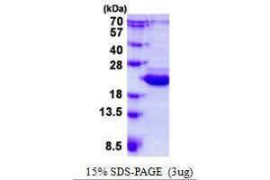 Figure annotation denotes ug of protein loaded and % gel used. (BCL2L10 Protein)