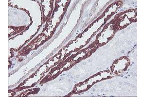 Immunohistochemical staining of paraffin-embedded Human Kidney tissue using anti-KIF2C mouse monoclonal antibody. (KIF2C antibody)