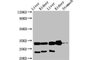 Western Blot Positive WB detected in: Rat liver tissue, Rat kidney tissue, Mouse liver tissue, Mouse kidney tissue, Mouse stomach tissue All lanes: TPSB2 antibody at 3 μg/mL Secondary Goat polyclonal to rabbit IgG at 1/50000 dilution Predicted band size: 31 kDa Observed band size: 31 kDa