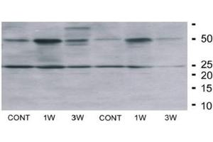 Fat Homogenates Stained by Irisin Antibody (FNDC5 antibody  (AA 42-112) (Magnetic Particles))