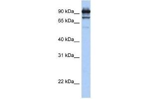 Western Blot showing STAT6 antibody used at a concentration of 1. (STAT6 antibody  (C-Term))