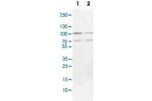 Western Blot analysis of Lane 1: NIH-3T3 cell lysate (mouse embryonic fibroblast cells) and Lane 2: NBT-II cell lysate (Wistar rat bladder tumor cells) with FOXP1 polyclonal antibody . (FOXP1 antibody)