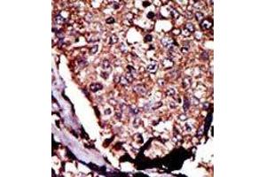 Image no. 2 for anti-Diacylglycerol Kinase, beta 90kDa (DGKB) (C-Term) antibody (ABIN360610)