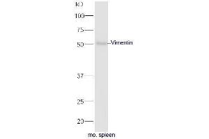 Western Blotting (WB) image for anti-Vimentin (VIM) (AA 371-466) antibody (ABIN672786)