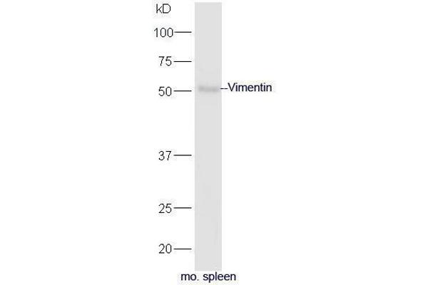 Vimentin Antikörper  (AA 371-466)