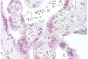 Anti-CHEK2 / CHK2 antibody IHC staining of human placenta. (CHEK2 antibody  (N-Term))