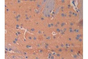Used in DAB staining on fromalin fixed paraffin- embedded kidney tissue (BMP5 antibody  (AA 201-314))
