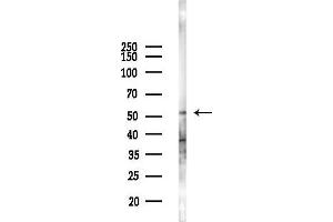 anti-Protein Phosphatase 2, Regulatory Subunit B'', gamma (PPP2R3C) (C-Term) antibody