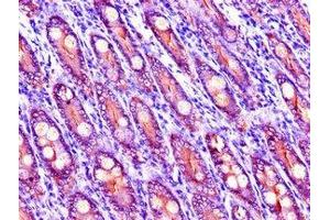 Immunohistochemistry of paraffin-embedded human small intestine tissue using ABIN7151743 at dilution of 1:100 (LIPG antibody  (AA 360-500))