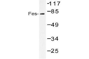 Western blot (WB) analysis of Fes antibody in extracts from HUVEC serum 20
