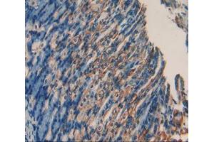 Used in DAB staining on fromalin fixed paraffin- embedded stomach tissue (RANKL antibody  (AA 92-263))