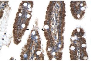 Human Intestine (PGRMC1 antibody  (N-Term))