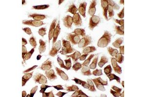 Anti-TRAM1 antibody, ICC ICC: HELA Cell (TRAM1 antibody  (C-Term))
